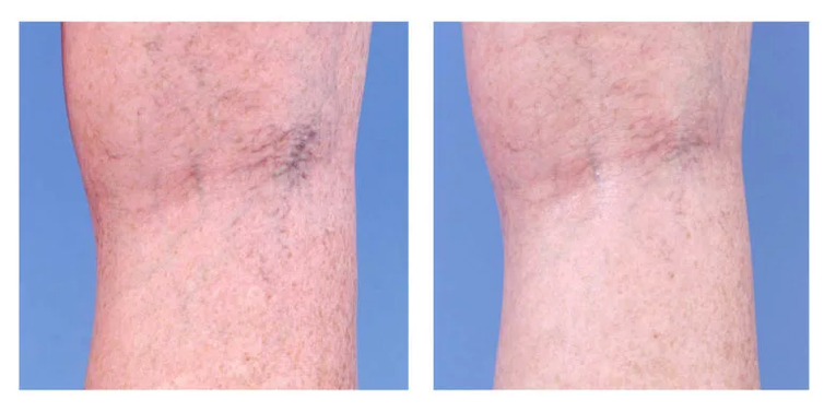 Cosmetische correctie